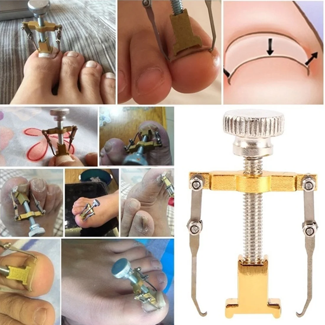 Инструмент для вросших ногтей педикюра Уход за ногтями на ногах инструменты файл