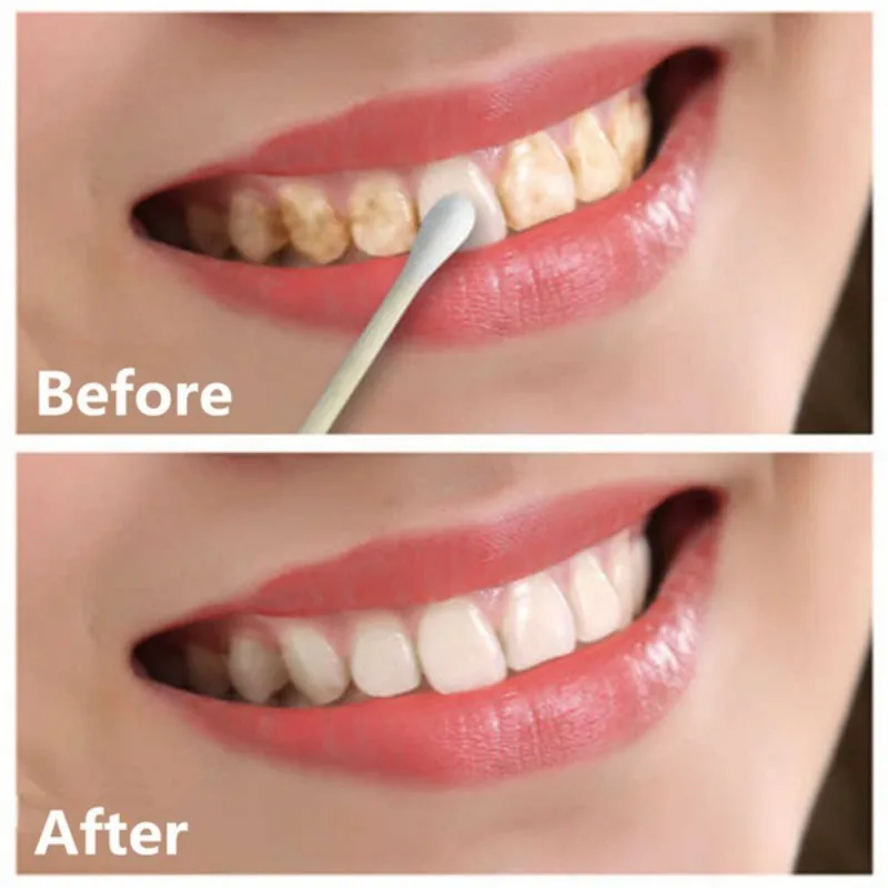 

Natural Teeth Whitening Pearl Tooth Powder Teeth Stain Remover Whitening Dental Oral HygienOral cleansing and whitening