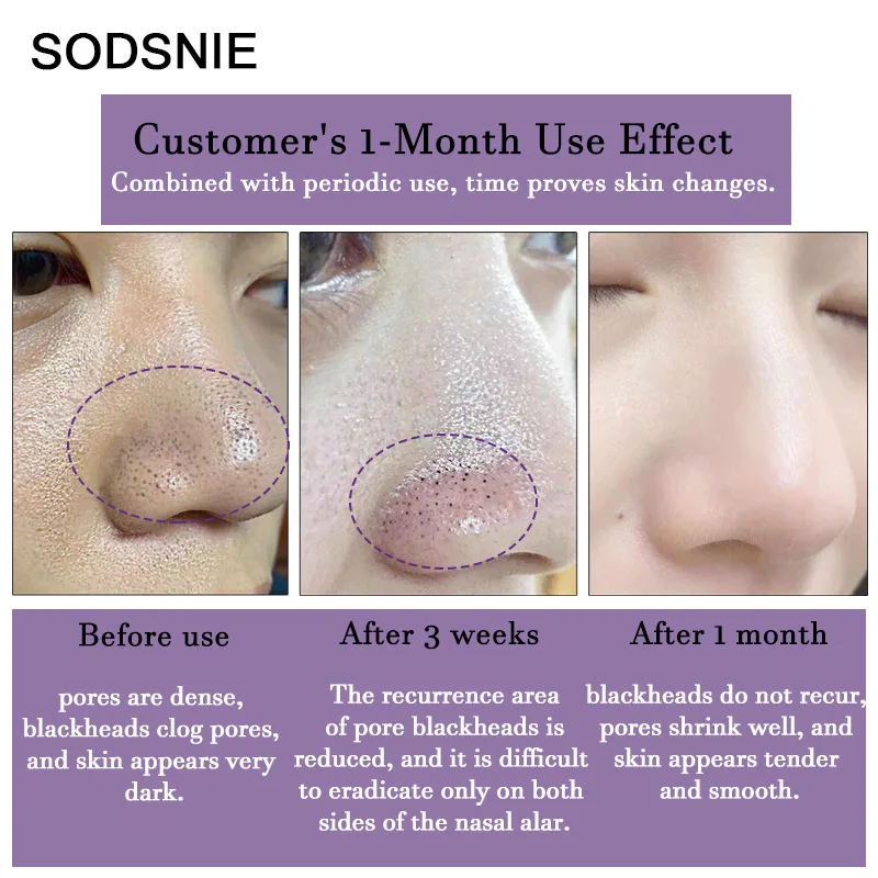 

Blackhead peeling facial mask cream with 40 sheets of nasal mask T zone care