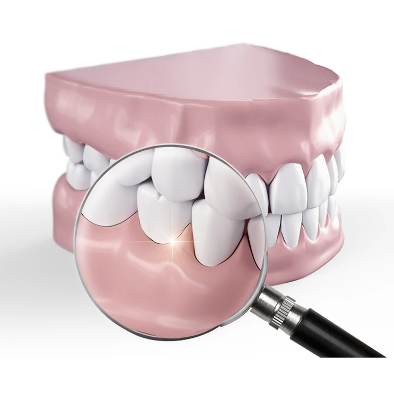 Временная зубная корона полость рта отбеливание зубов передняя Корона резина