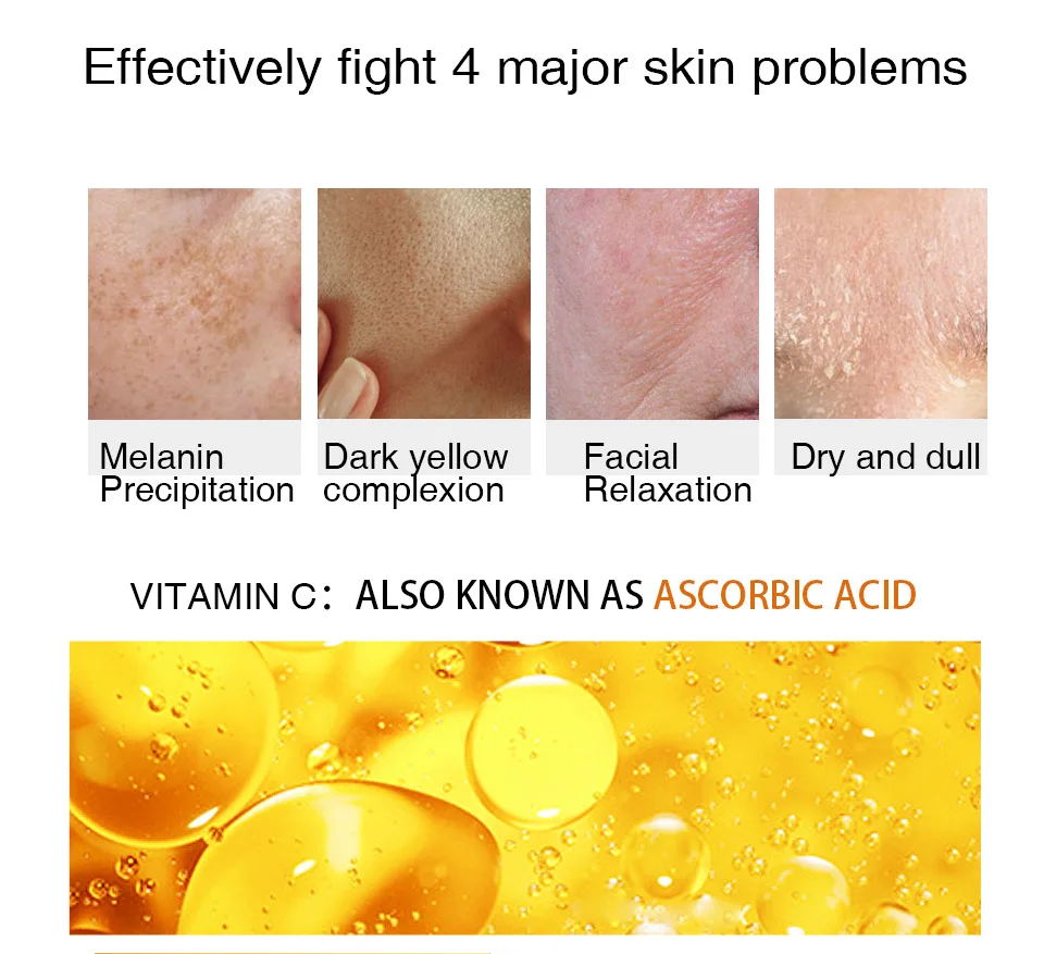 Витамин C 20% VC отбеливающий крем для лица ремонта выцветает веснушки удаления