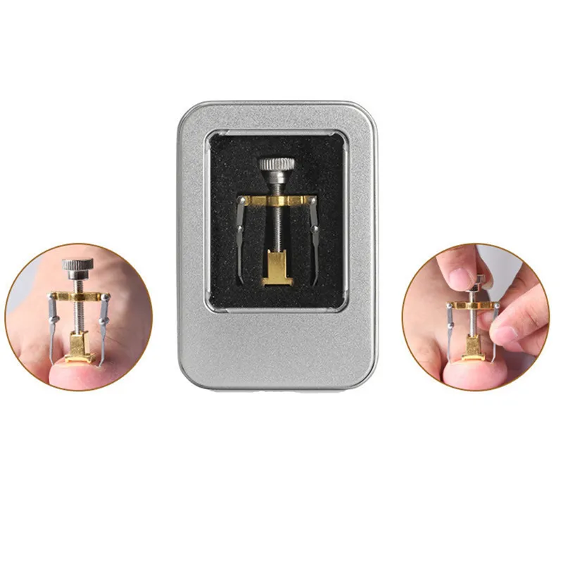 1 шт. инструмент для коррекции вросших пальцев ног ногтей педикюр закрепитель на