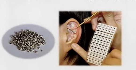 600 шт./лот расслабляющие наклейки для ушей иглоукалывание иглы семена массажа