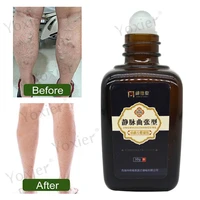 varicose gel serum relieve pain leg swelling remove earthworm legs swelling of blood vessels cold compress foot skin care 30g