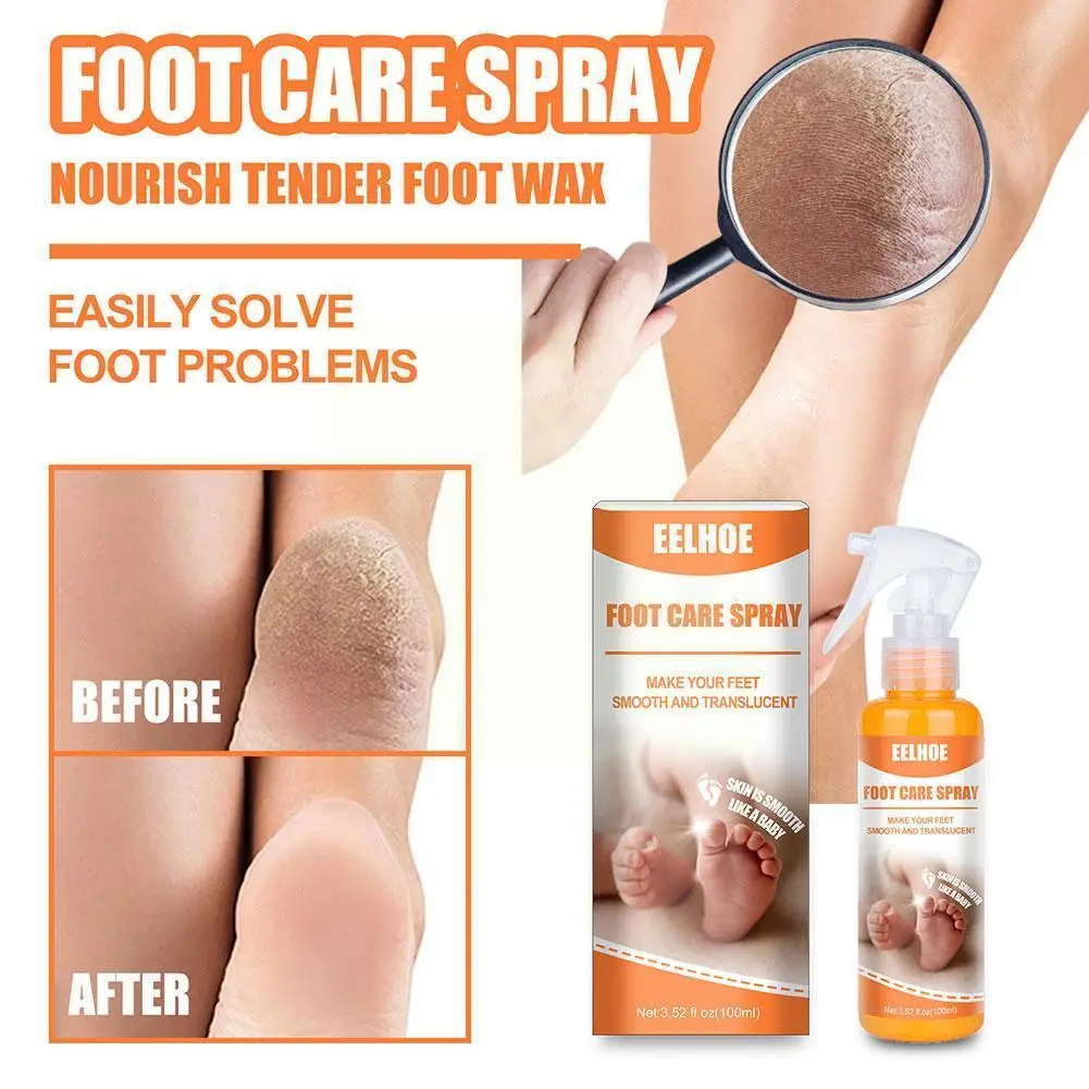 

Спрей для ухода за ногами 40/100 мл, средство для удаления омертвевшей кожи, увлажняющие восстанавливающие носки, инструмент для ухода за коже...