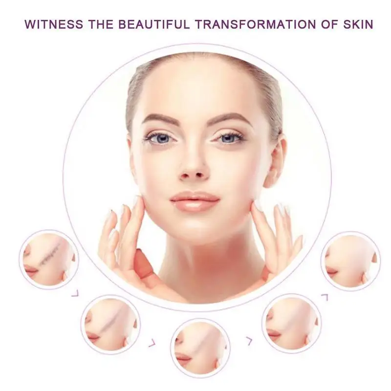 Крем удаляющий Шрамы Акне ремонт от черных точек прыщей акне угрей поры кожи