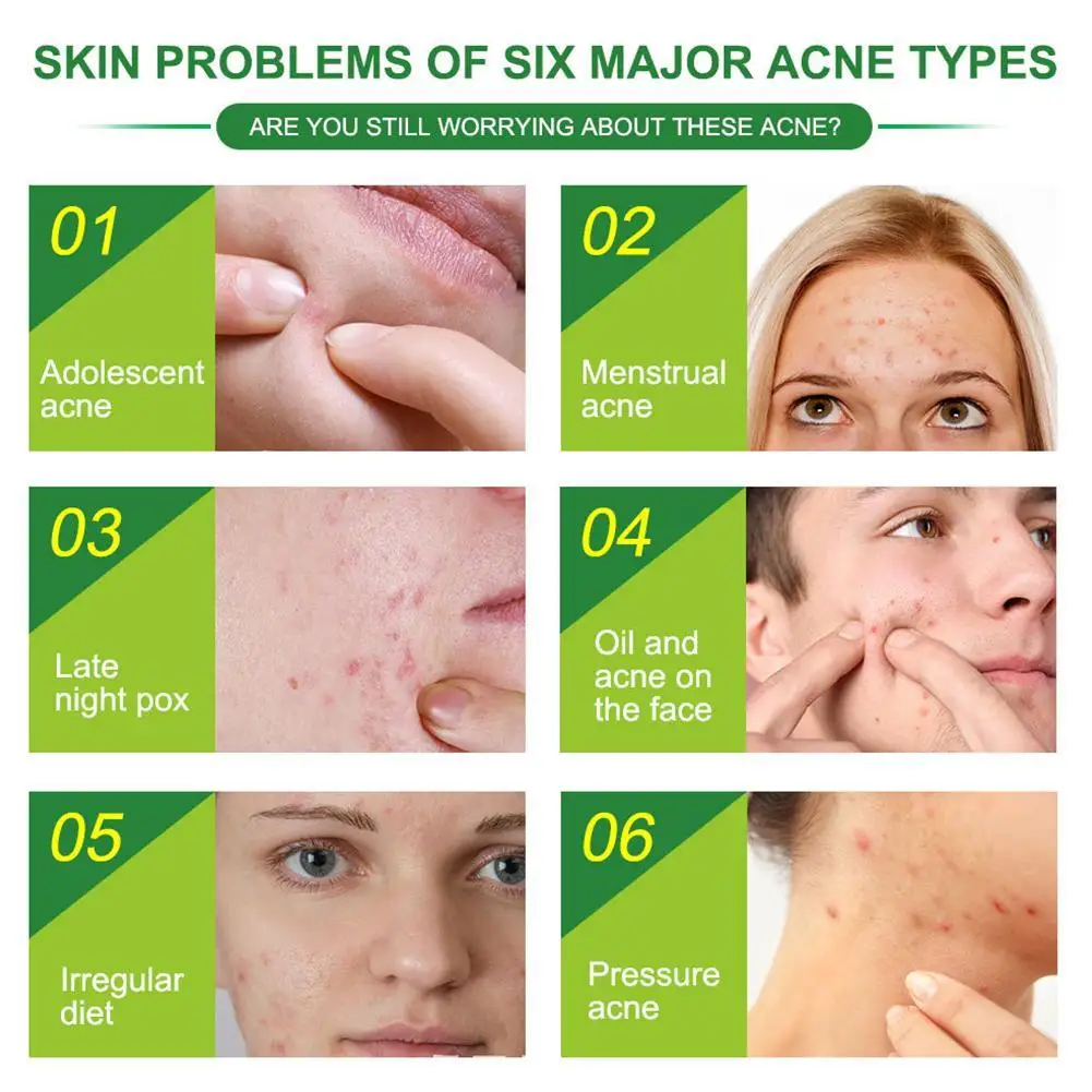 24 шт невидимые акне Удаление прыщей патч может поглощать выделений эффективно