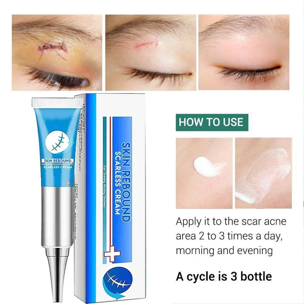 Scar Repair Cream Acne Treatment Face Blackhead Repair Moisturizer Whitening Skin Pores Care Oil Control Gel Shrink Scar M0Z1