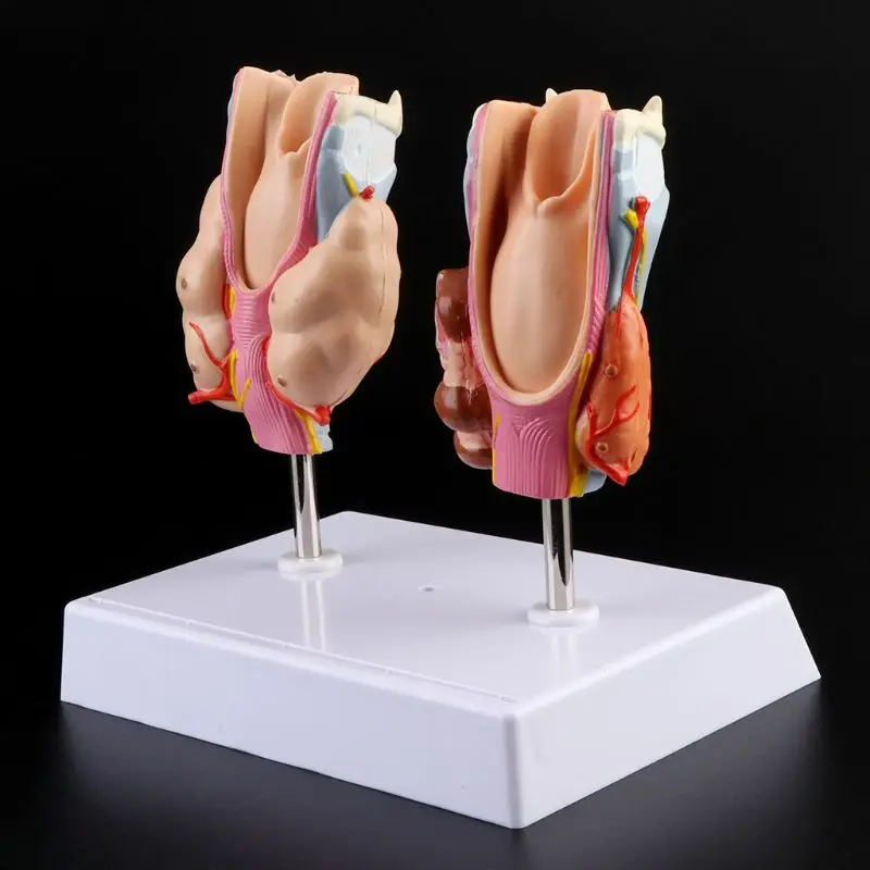 

50LA Human Thyroid Anatomical Pathology Model Normal and Disease Pathologies Teaching Resource Tool