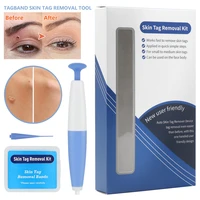 skin tag remover kit natural micro painless auto mole wart remover equipment wart remove pen easy to clean skin beauty care tool