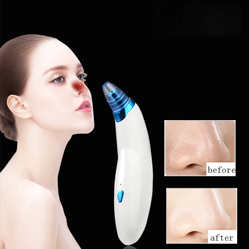 

New Electric Blackhead Instrument Home Massage Instrument Multifunctional Beauty Instrument Pore Cleaning Artifact