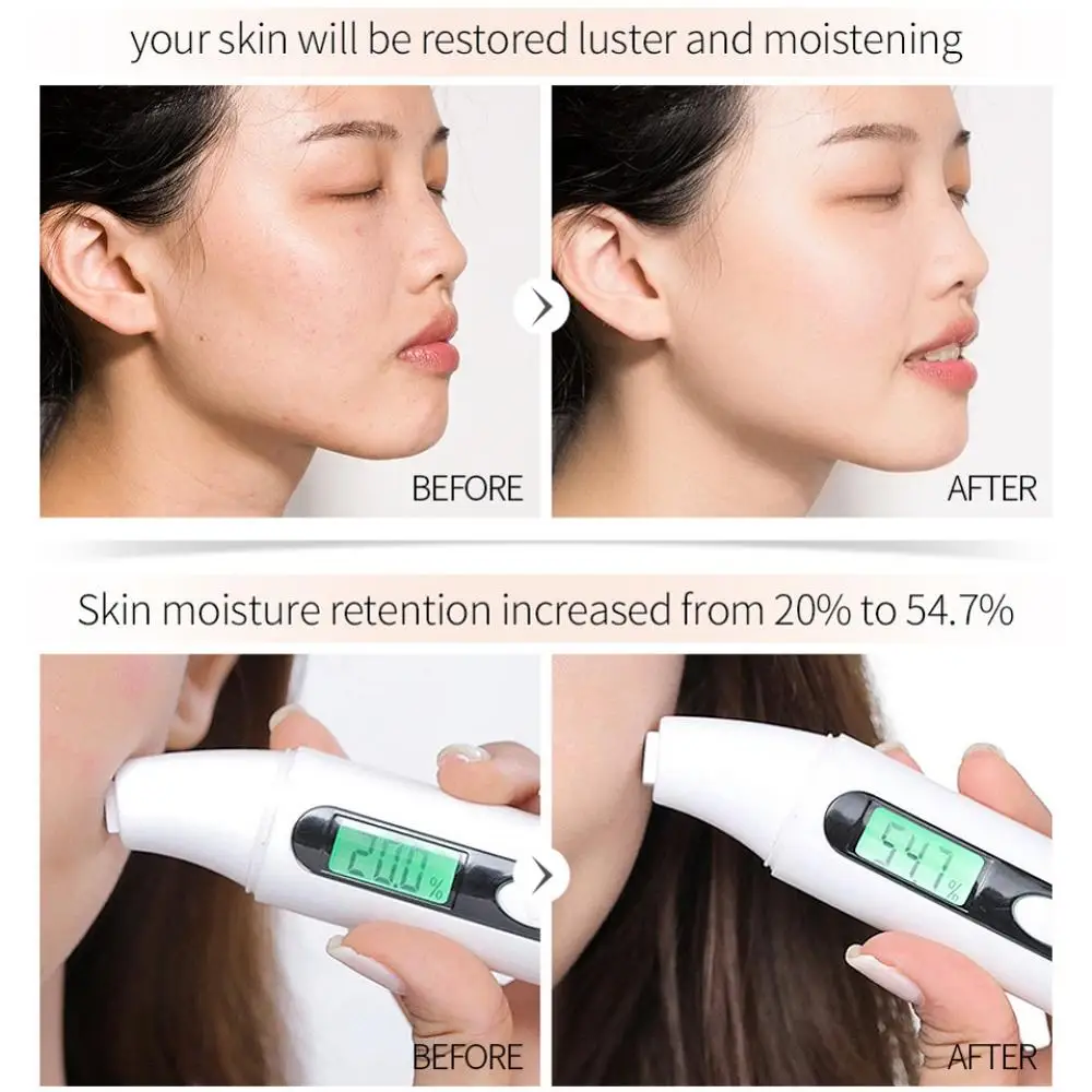 

Vitamin C Essential Liquid Moisturizing Hyaluronic Acid Firming Skin Dilute Freckles Brighten Skin Color Face Serum 15ml