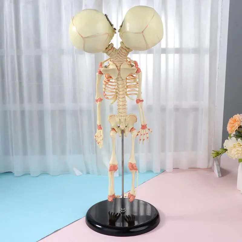

37cm Human Double Head Baby Skull Skeleton Anatomy Brain Display Study Teaching Anatomical Model Q1JC