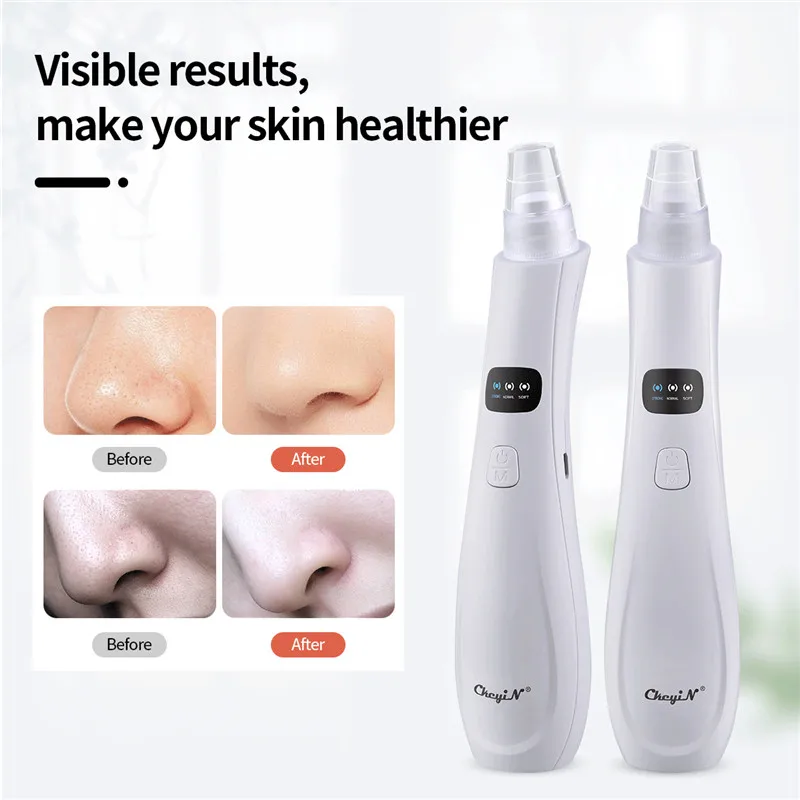 

CkeyiN Face Blackhead Remover Vacuum Pore Suction Clean singNose Deep Cleaner Acne Comedo Face Exfoliator Rechargeable Tool