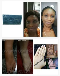 Мыло с древесным углем, отбеливание, уменьшение темных пятен, мягкая кожа, очистка темных костяшек, 100 г, бесплатная доставка