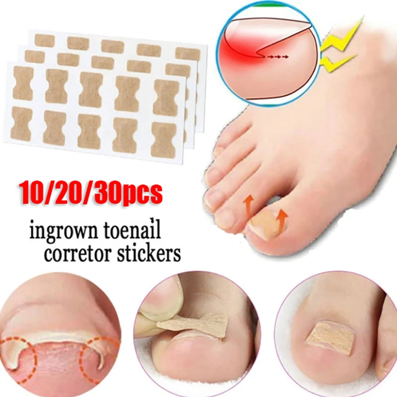Корректор для вросшего ногтя наклейка полоска ногтей антирулон клей без