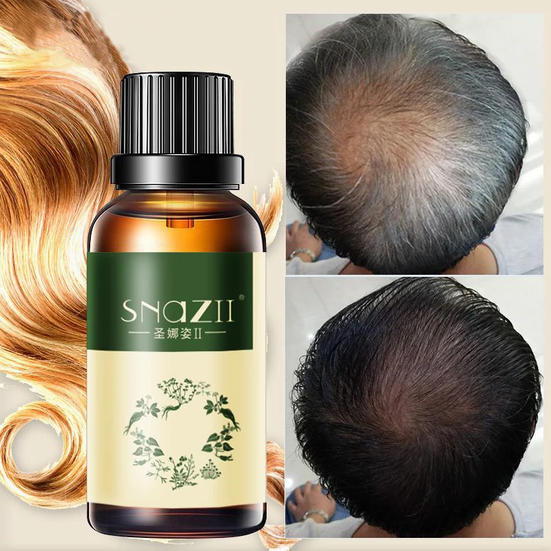 

Hair shampoo oil the best effect for hair growth and hair loss prevent premature thinning of hair for men and women