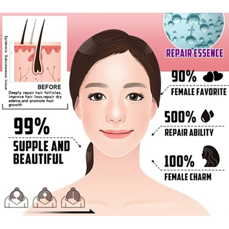 Новинка 2021 сыворотка для быстрого роста волос 20 мл жидкость предотвращения