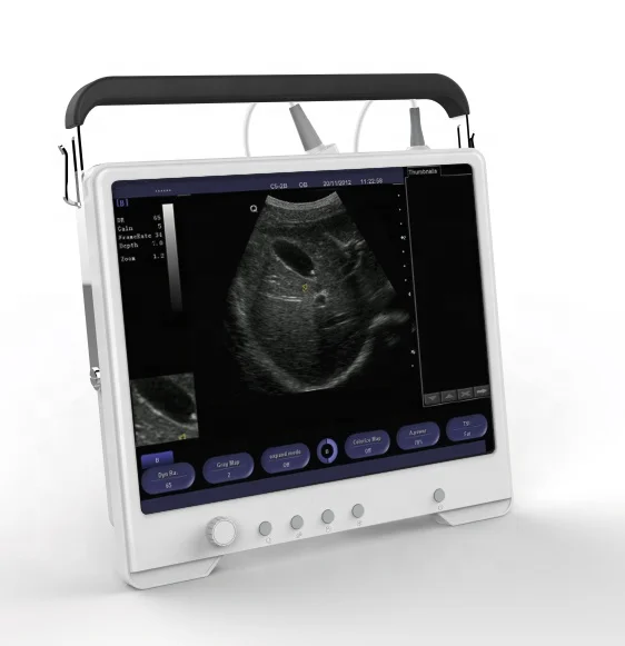 

2021 new touch screen medical vet ultrasound veterinary price