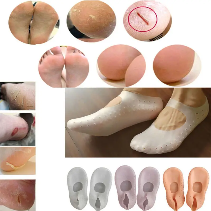 2020 Newest Hot 1Pair Silicone Moisturizing Gel Heel Socks Cracked Foot Skin Care Protector Sock Slippers | Женская одежда