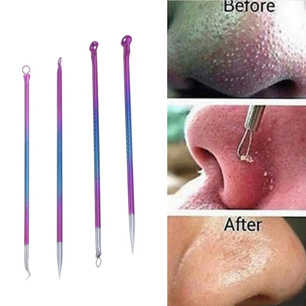 

Color Acne Needle 4-piece Set Free Nose Stick Steel Acne Beauty Needle Double-headed Set Needle Blackhead P7J4