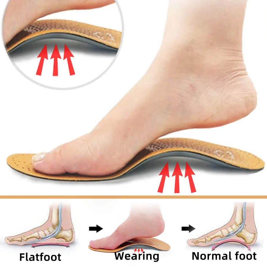 

Leather Orthotics Insoles for Flat Foot Arch Support 25mm Orthopedic Silicone Insoles for Men and Women 1 pair (EU 35 to 46)