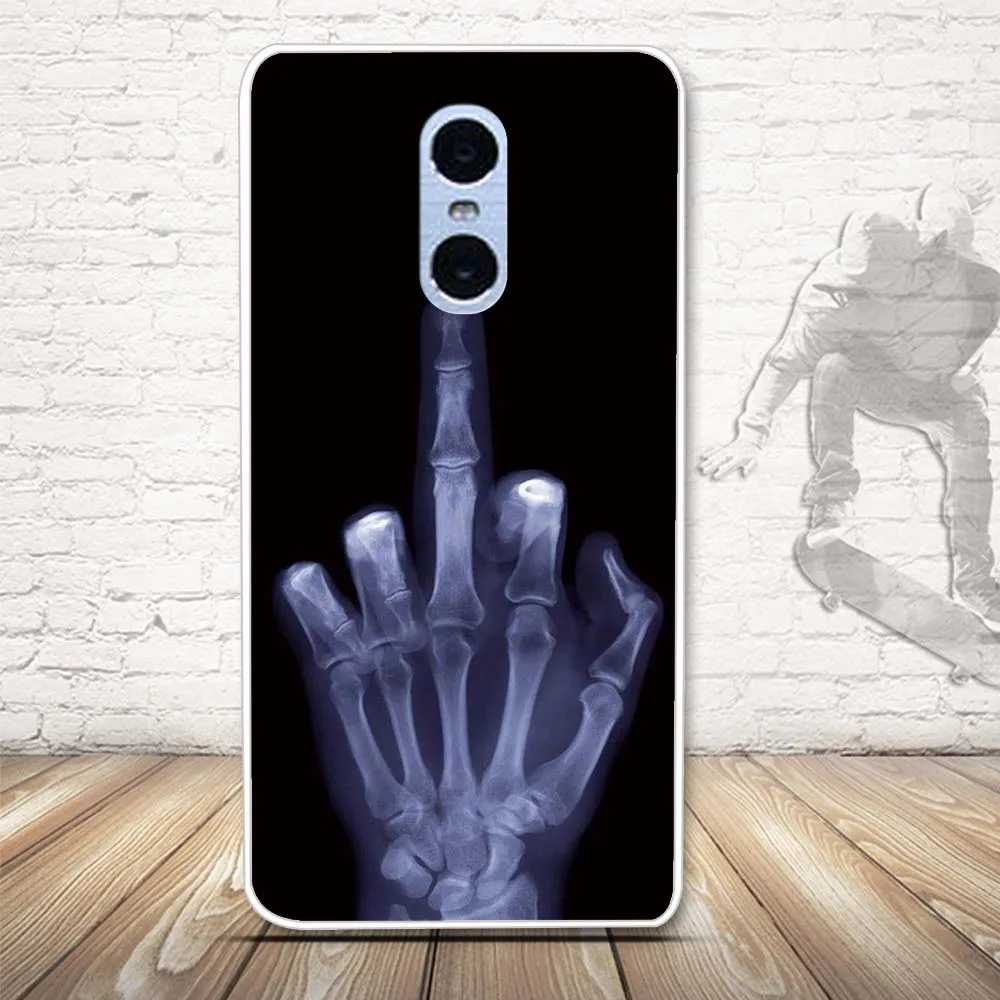Для Xiaomi Redmi Pro чехол s силиконовый чехол для Xiomi Redmi Pro Защитный Мягкий ТПУ чехол для Xiaomi Redmi Pro 5,5 дюймов Чехол