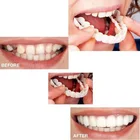 Силиконовые отбеливающие зубные накладки, 2 шт.компл., имитация протеза, набор зубных протезов для верхнихнижних зубов, в коробке, ортодонтические скобы