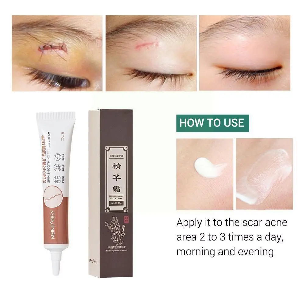 

1 шт., крем для удаления шрамов, 20 г