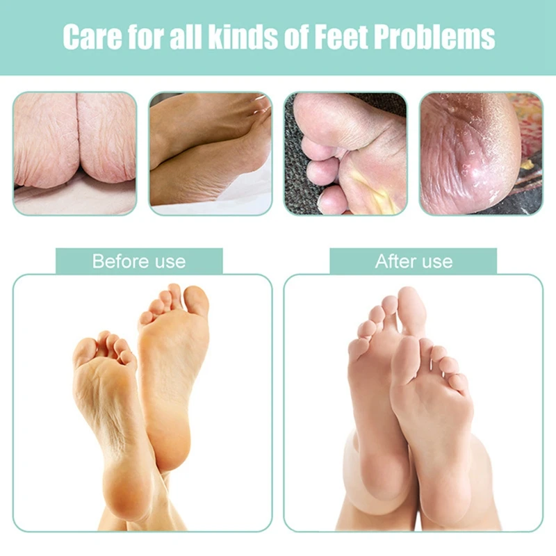 

1Pcs Electric Pedicure Tools, Foot File, Foot Exfoliating File, Dead Skin Cuticle Remover, Scrubber, Pedicure