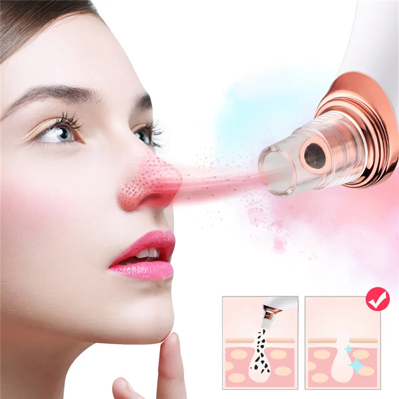 

Face Skin Srcubber Blackhead Deep Cleaner Extractor Vacuum Peeling Ance Pimple Removal Nose T-Zone Skin Care Nano Mist Sprayer