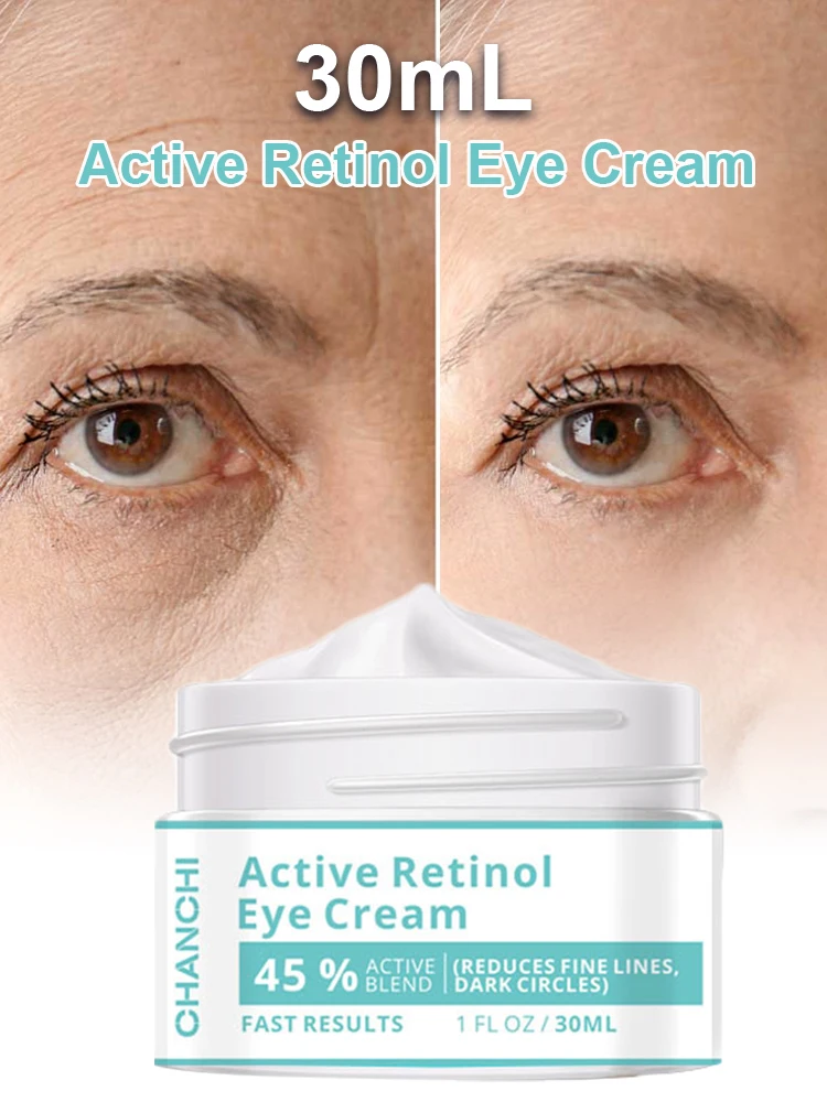 

CHANCHI 30ml Eye Cream Active Retinol Eye Lift Care Cream Remove Fine Line Wrinkle Dark Cricle Puffiness Anti-Sagging Paste