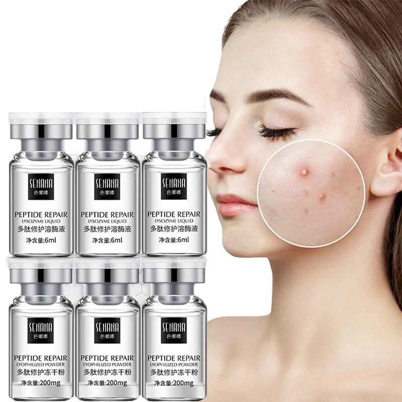 

Lyophilized Powder Repair Skin Hydrating Anti-aging Skin Tightening Acne Oligopeptide - 1 Face Serum Skin Care Dropshopping