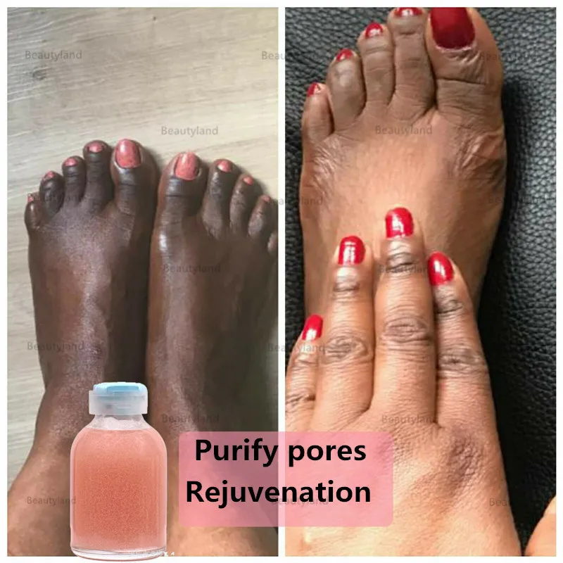 

Strong Hand and Feet Lightening Whitening Cleansing Serum To Clean Up Dark Knuckles Melting and brightening the Skin 30ml
