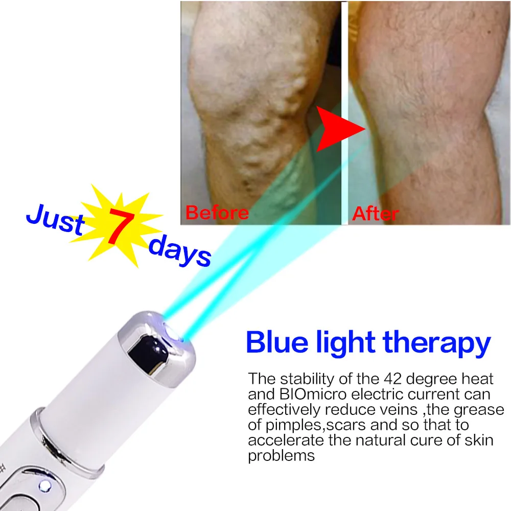 Медицинская лазерная ручка для лечения акне с синим светом устройство мягкого