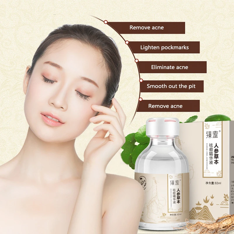 1PC Herbal Acne Remove Pimple Oil-control Smooth skin Serum Shrink Pores Fade Printing and Repair Face Centella Blain Face Serum