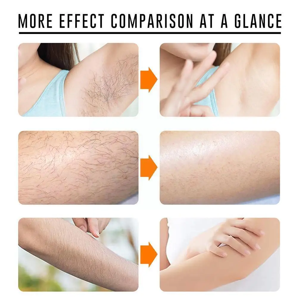 

50g Permanent Painless Hair Removal Spray Bikini Skinny Armpits Growth Body Hair Serum Legs Skin Smooth Inhibit Repair Y5N1