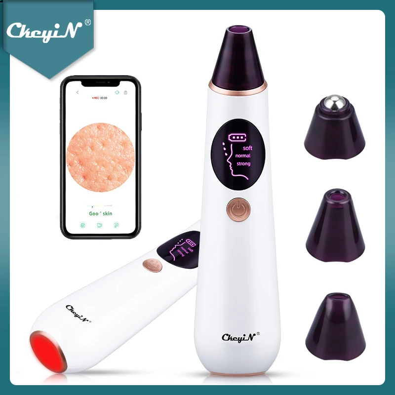 

CkeyiN Visual Blackhead Remover Pore Vacuum Camera Wifi 10X Magnification Real Time Hot Compress Acne Extractor Facial Cleaner