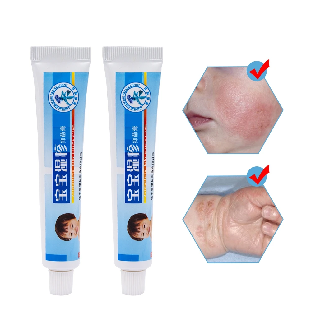 

2pcs Body Eczema Cream Natural Ointment Psoriasi Pruritus Cream Dermatitis Baby Anti-itch Ointment Skin Treatment Cream D1765