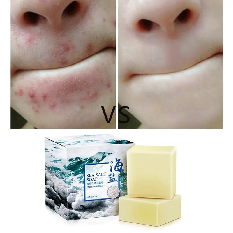 100 г морской соли очиститель для лица против клещей мыло Удаление прыщей поры