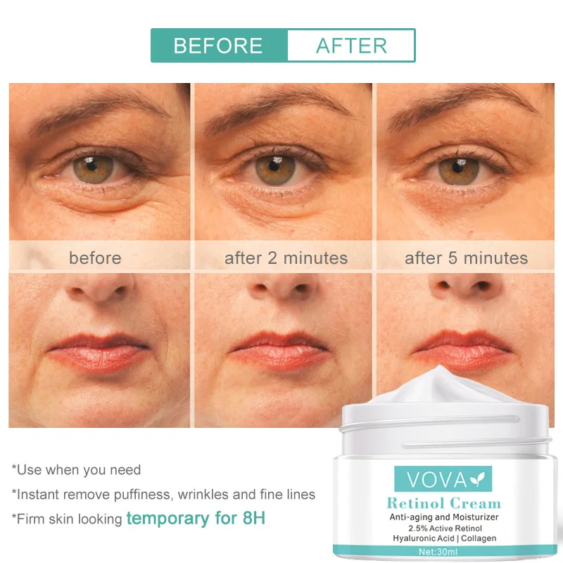 VOVA Retinol Anti Wrinkle Face Cream Collagen Hyaluronic Acid Shrink Pores Firming Improve Puffiness Moisturizing Skin Care | Красота и