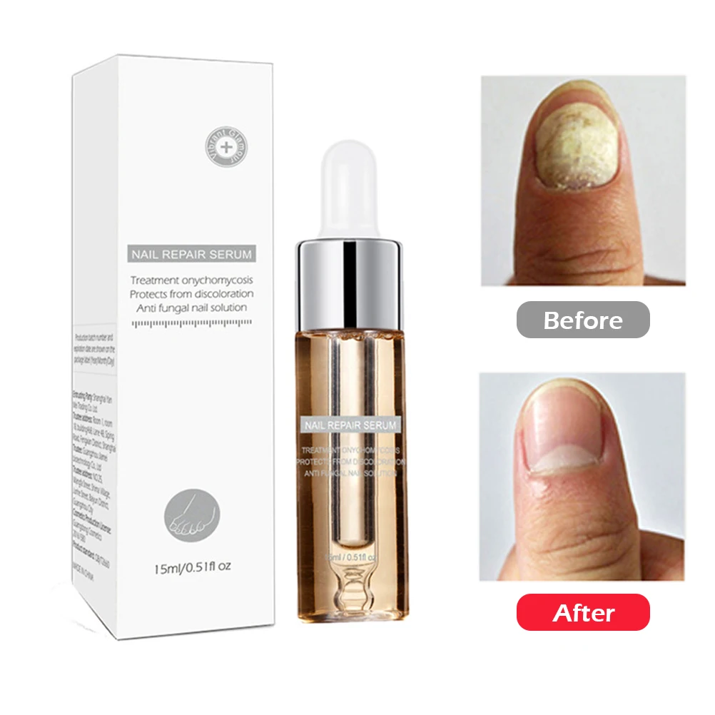 Жидкая Антибактериальная эссенция для восстановления ногтей 15 мл|Средства ухода