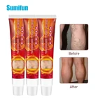 Устройство для лечения варикозного расширения вен и ангиита, 3 шт.