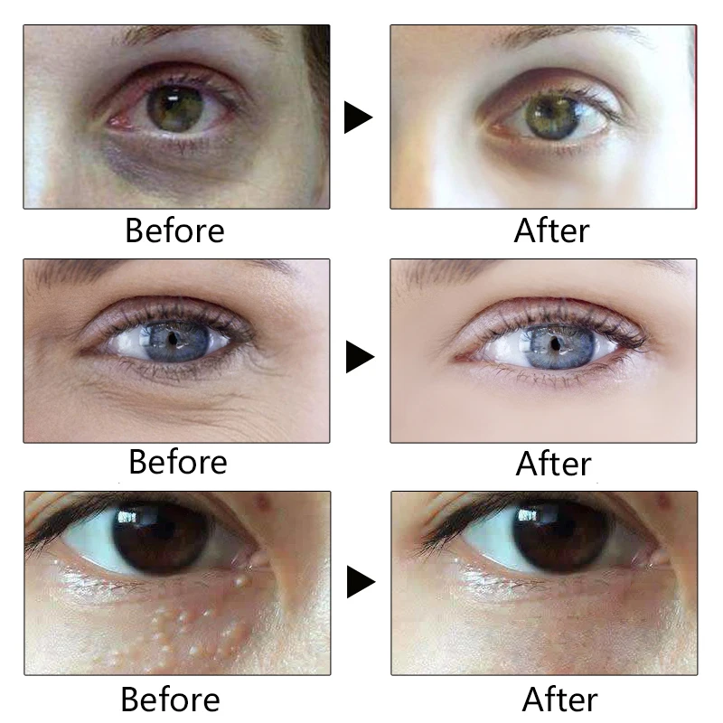 

EFERO Anti Aging Eye Cream Against Blue Light Whitening Dark Circles Remove Eye Care Anti-aging Firming Eye Serum Skin Care