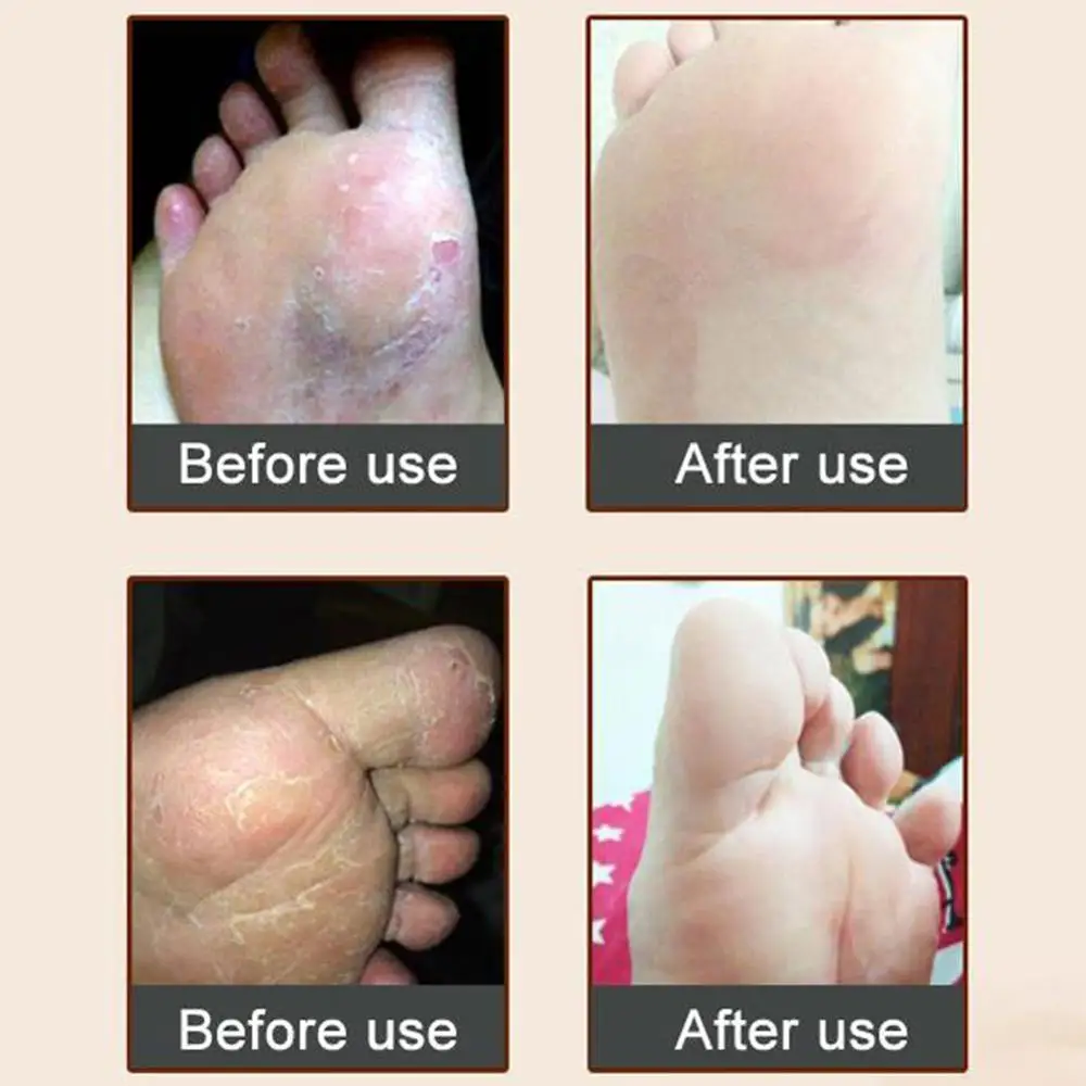 

Thai general Rheumatism Balm Ointment Joint Arthritis Medical Chinese Aches Pain Oil Cooling Relief Plaster Cream Muscle Ru E5Q9