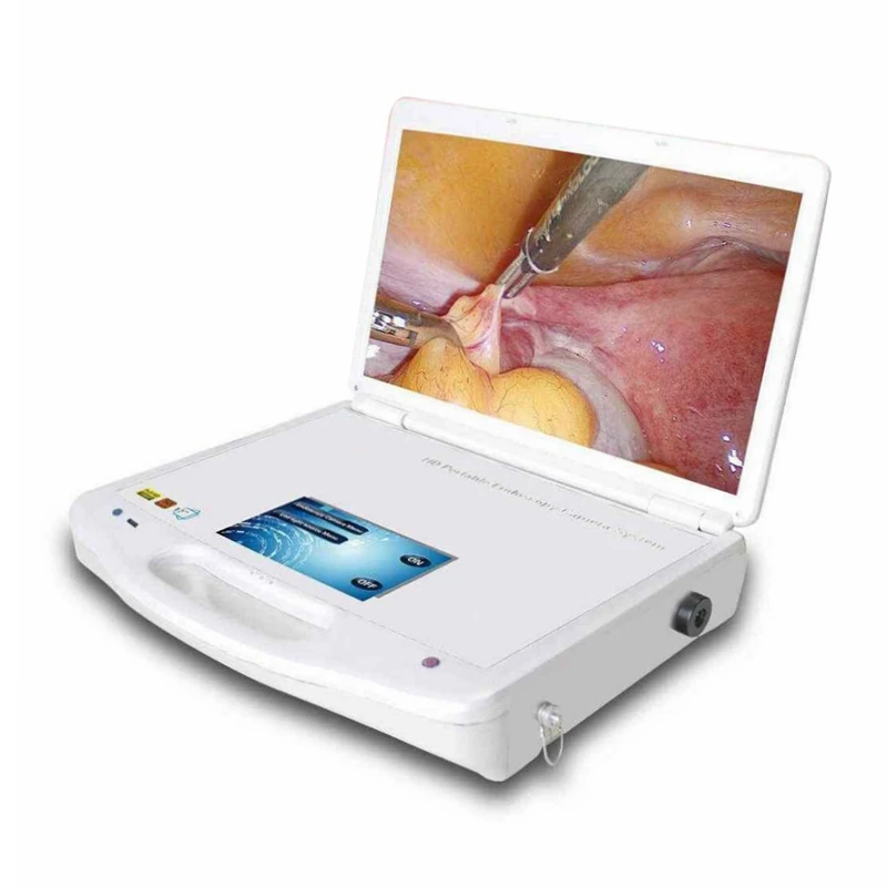 

Endoscope inspection HD camera Medical Endoscope CCD Camera for ENT endoscope camera