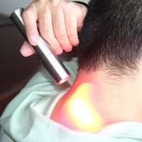 red light therapy freckle tattoo removal picosecond pen skin mole scar removal dark spot remover pen acne skin pigment remover