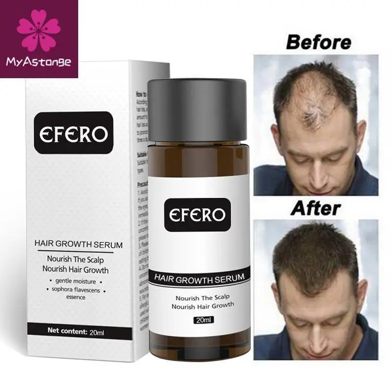 

EFERO Fast Powerful Hair Growth Oil Hair Loss Products Essential Oil Regrow Dense Hair Restoration Growing Serum Hair Care 20ml