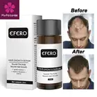 Быстрое мощное масло для роста волос EFERO, продукты против выпадения волос, эфирное масло, восстановление плотности, восстановление волос, сыворотка для роста волос, уход за волосами 20 мл