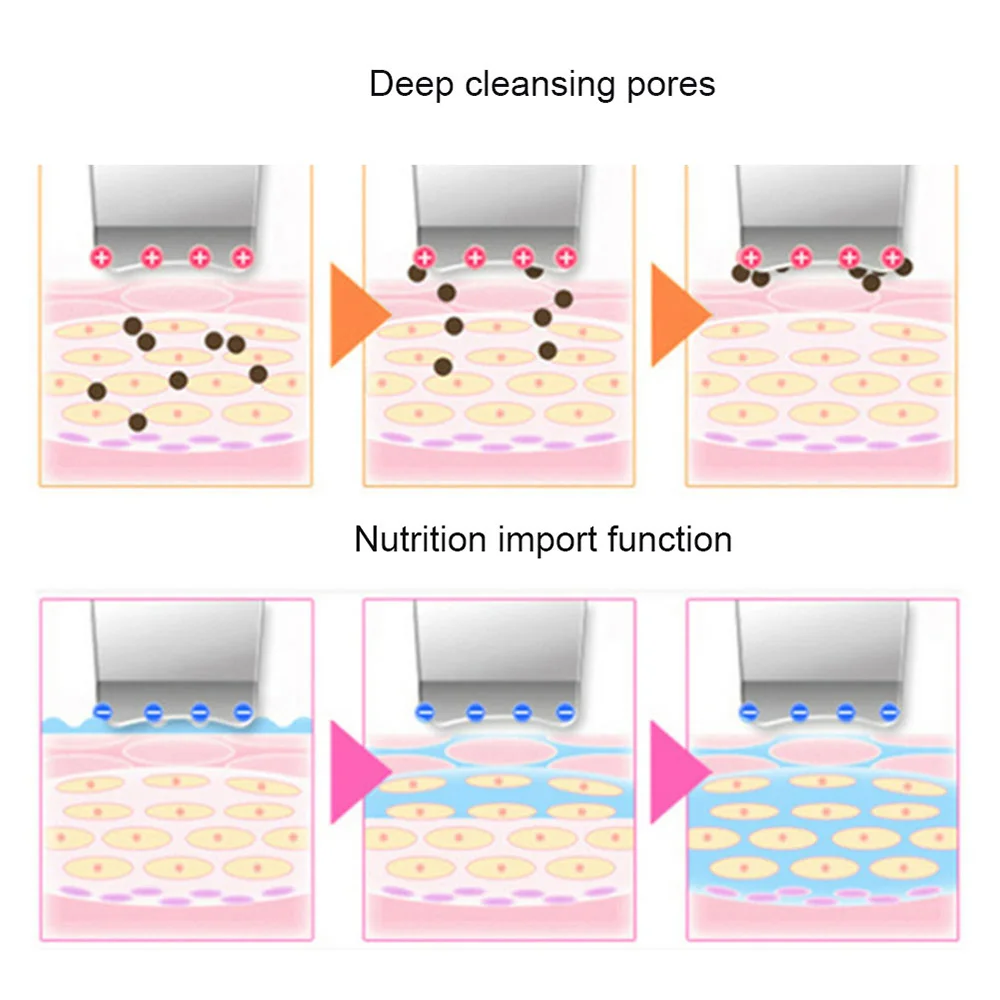 Ультразвуковой глубокий аппарат для чистки лица скруббер удаления грязи Угри
